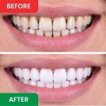 WellaSmile image